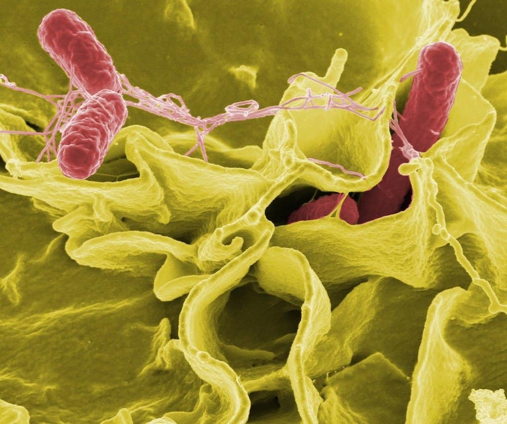 microscopic image of e coli bacteria